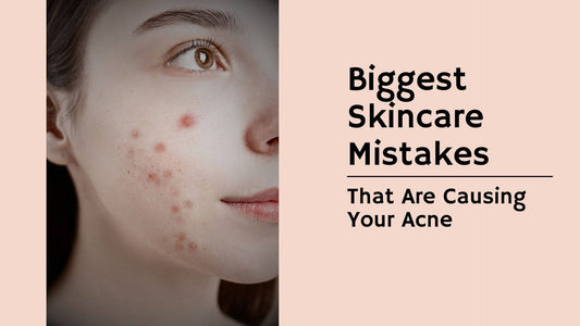 Biggest Skincare Mistakes That Are Causing Your Acne